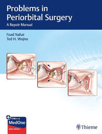 Problems in Periorbital Surgery : A Repair Manual - Foad Nahai