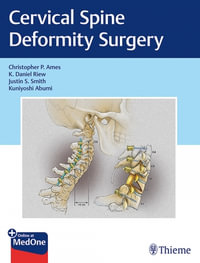 Cervical Spine Deformity Surgery - Christopher P. Ames
