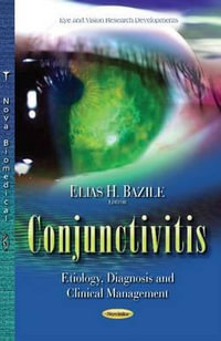 Conjunctivitis : Etiology, Diagnosis & Clinical Management - Elias H Bazile