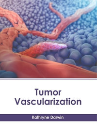 Tumor Vascularization - Kathryne Darwin