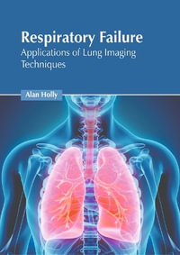 Respiratory Failure : Applications of Lung Imaging Techniques - Alan Holly