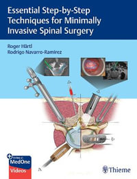 Essential Step-by-Step Techniques for Minimally Invasive Spinal Surgery - Roger Hartl