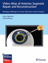 Video Atlas of Anterior Segment Repair and Reconstruction : Managing Challenges in Cornea, Glaucoma, and Lens Surgery - Amar Agarwal