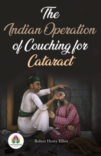 The Indian operation of couching for cataract - Robert Henry Elliot