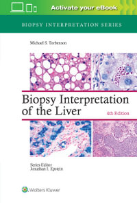 Biopsy Interpretation of the Liver : Biopsy Interpretation Series, 4th Edition - Michael Torbenson