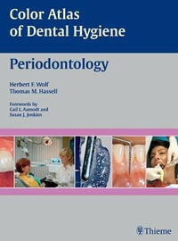 Periodontology : Color Atlas of Dental Hygiene - Herbert F. Wolf