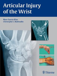 Articular Injury of the Wrist : FESSH 2014 Instructional Course Book - Christophe Mathoulin