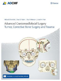 Advanced Craniomaxillofacial Surgery : Tumor, Corrective Bone Surgery, and Trauma - Michael Ehrenfeld