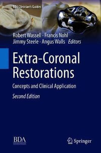 Extra-Coronal Restorations : Concepts and Clinical Application - Robert Wassell