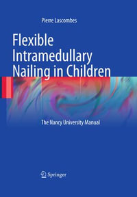 Flexible Intramedullary Nailing in Children : The Nancy University Manual - Pierre Lascombes