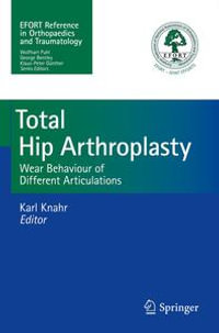 Total Hip Arthroplasty : Wear Behaviour of Different Articulations - Karl Knahr