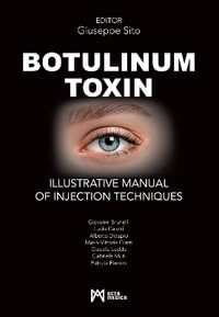 Botulinum Toxin : Illustrative Manual of Injection Techniques - Giuseppe Sito