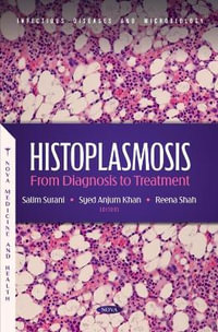 Histoplasmosis : From Diagnosis to Treatment - Salim Surani