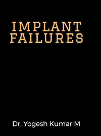 implant failures - Dr.Yogesh kumar M