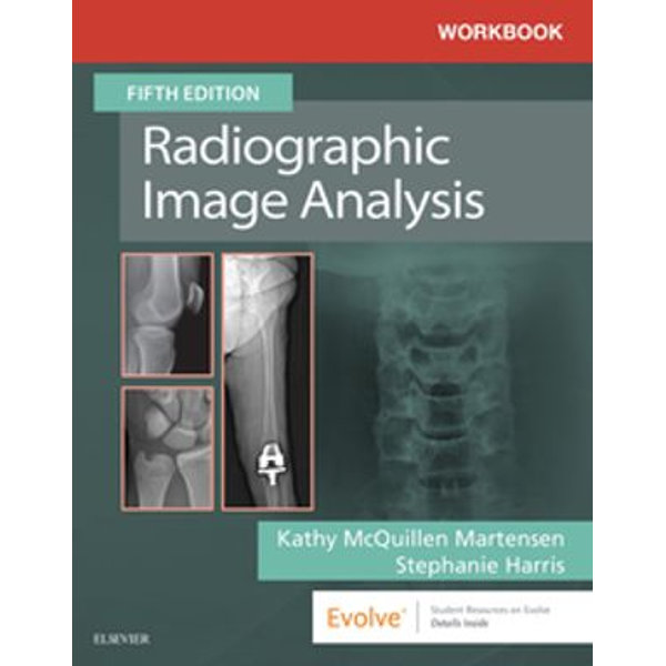 Workbook for Radiographic Image Analysis E-Book - 	 | Karta-nauczyciela.org