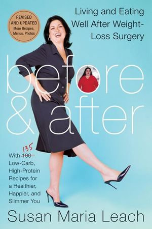 Before & After, Revised Edition : Living and Eating Well After Weight-Loss Surgery - Susan Maria Leach