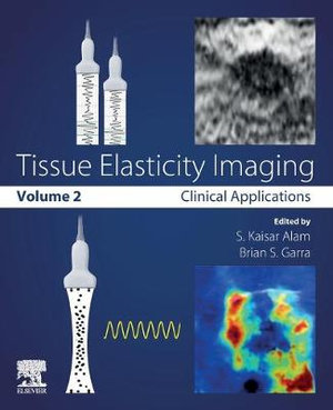 Tissue Elasticity Imaging : Volume 2: Clinical applications - Alam