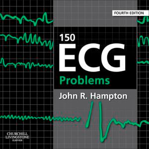 150 ECG Problems E-Book : 150 ECG Problems E-Book - John Hampton