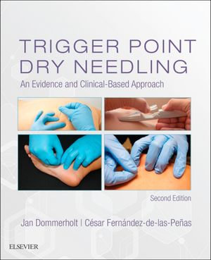 Trigger Point Dry Needling : 2nd Edition - An Evidence and Clinical-Based Approach - Jan Dommerholt