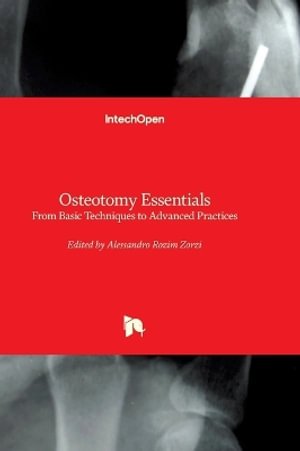 Osteotomy Essentials - From Basic Techniques to Advanced Practices : From Basic Techniques to Advanced Practices - Alessandro Rozim Zorzi