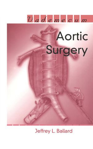 Aortic Surgery - Jeffrey L. Ballard
