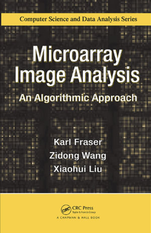 Microarray Image Analysis : An Algorithmic Approach - Karl Fraser