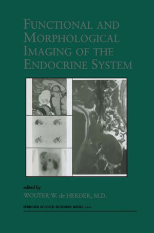 Functional and Morphological Imaging of the Endocrine System : Endocrine Updates : Book 7 - W.W. de Herder