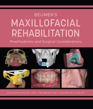 Beumer's Maxillofacial Rehabilitation - Prosthodontic and Surgical Considerations - Arun Sharma