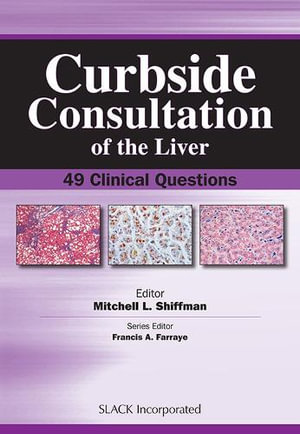 Curbside Consultation of the Liver : 49 Clinical Questions : 49 Clinical Questions - Mitchell Shiffman