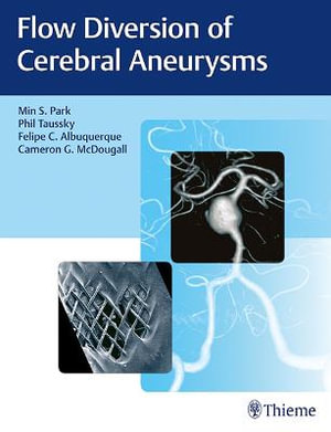 Flow Diversion of Cerebral Aneurysms - Min S. Park