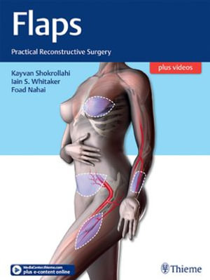 Flaps : Practical Reconstructive Surgery - Kayvan Shokrollahi