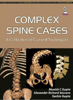 Complex Spine Cases : A Collection of Current Techniques - Alexander R Vaccaro